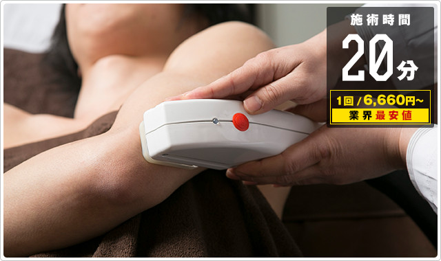 ひじ上脱毛が20分6000円！