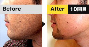 ビフォ―アフター1