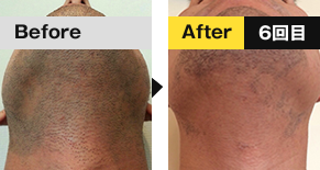 ビフォ―アフター3