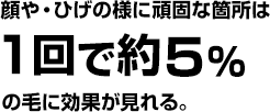 頑固なひげでも１回で効果を実感