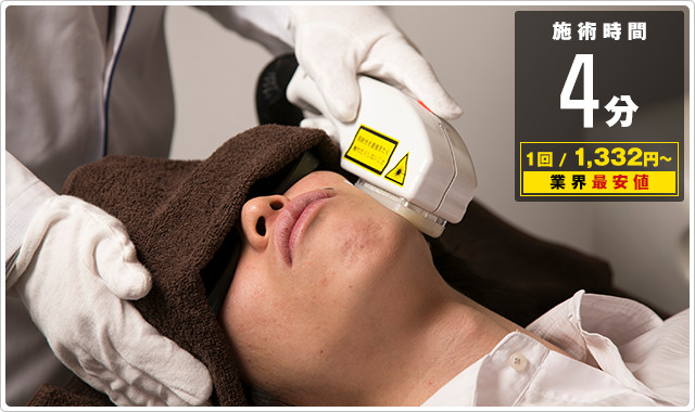 両頬の脱毛がたった４分！