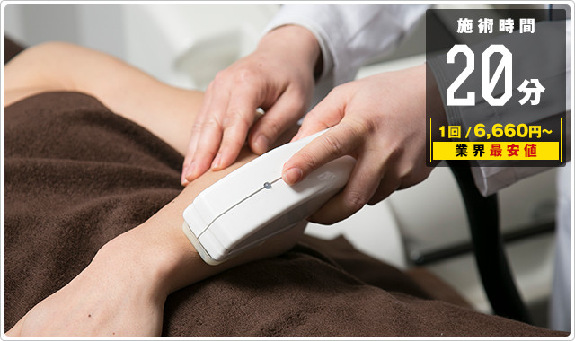 ひじ下脱毛が20分6000円！