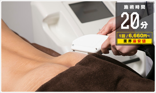 おしり脱毛が20分6000円！