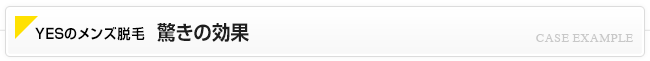 YESの脱毛効果に驚き!