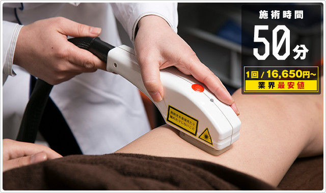 ひざ下脱毛が50分15000円！