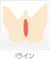 Iライン