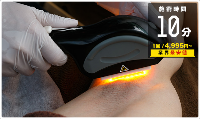 ワキ脱毛が10分3000円！