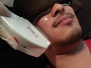 60分　男性脱毛