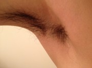 脇　男性脱毛