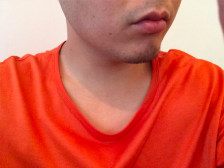 敏感肌　男性脱毛