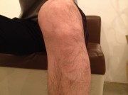 30分　男性脱毛