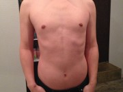 全身脱毛 メンズ脱毛