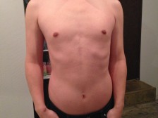 全身脱毛　メンズ脱毛