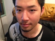 顔脱毛　男性脱毛